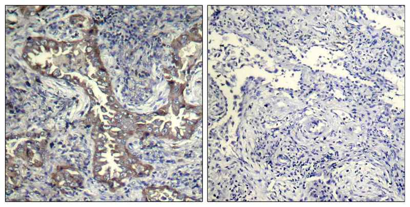Keratin 19 Antibody