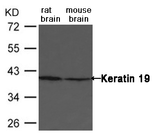 Keratin 19 Antibody