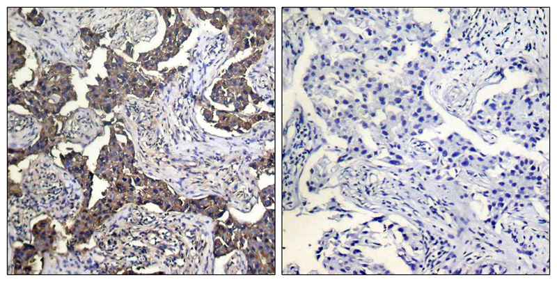 Keratin 19 Antibody