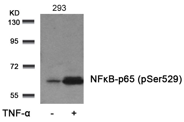 NFkB-p65(Phospho-Ser529) Antibody