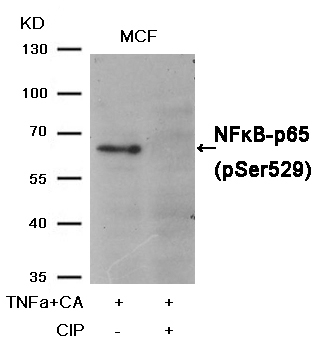 NFkB-p65(Phospho-Ser529) Antibody