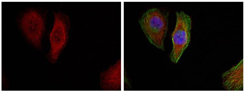 p44/42 MAP Kinase(Phospho-Thr202) Antibody