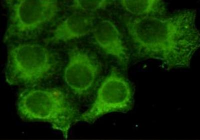 Keratin 18 Monoclonal Antibody