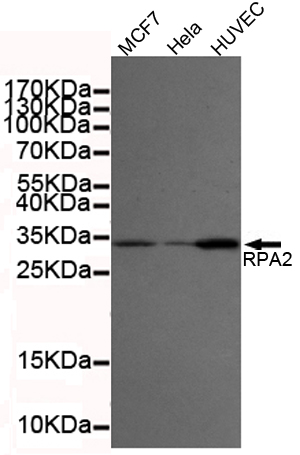 RPA32/RPA2 Monoclonal Antibody
