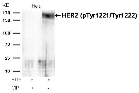 HER2(Phospho-Tyr1221/Tyr1222) Antibody