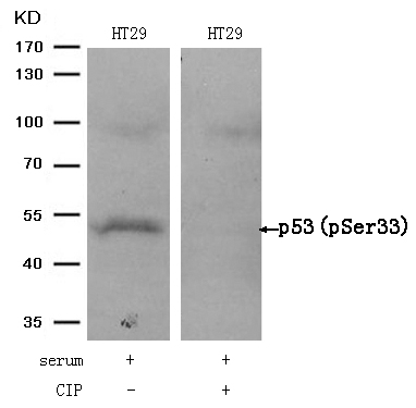 p53(Phospho-Ser33) Antibody