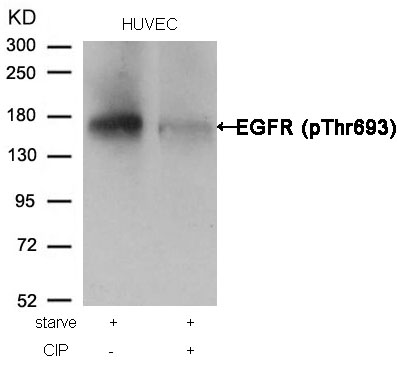 EGFR(Phospho-Thr693) Antibody