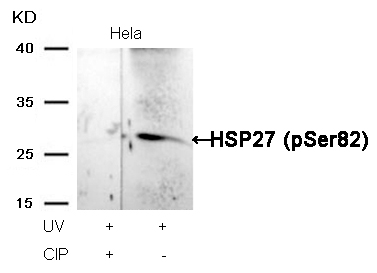 HSP27(Phospho-Ser82) Antibody