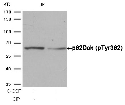 p62Dok(phospho-Tyr362) Antibody