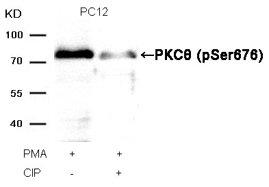 PKCth(Phospho-Ser676) Antibody