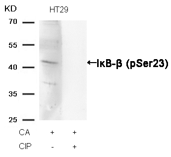 IkB-b(Phospho-Ser23) Antibody