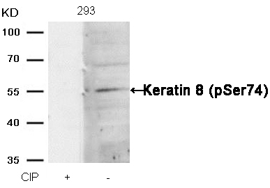 Keratin 8(Phospho-Ser74) Antibody