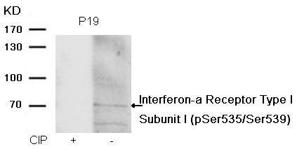 IFNAR1 Subunit1 (phospho-Ser535/Ser539) Antibody