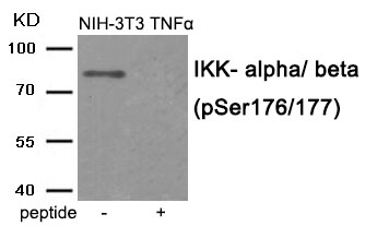 IKK- alpha/ beta (Phospho-Ser176/177) Antibody