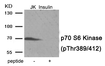 p70 S6 Kinase (Phospho-Thr389/412) Antibody