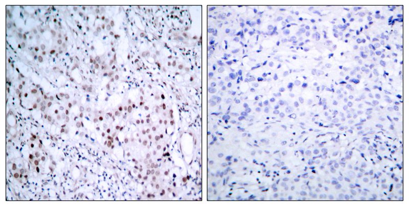 c-Jun (Phospho-Ser63) Antibody