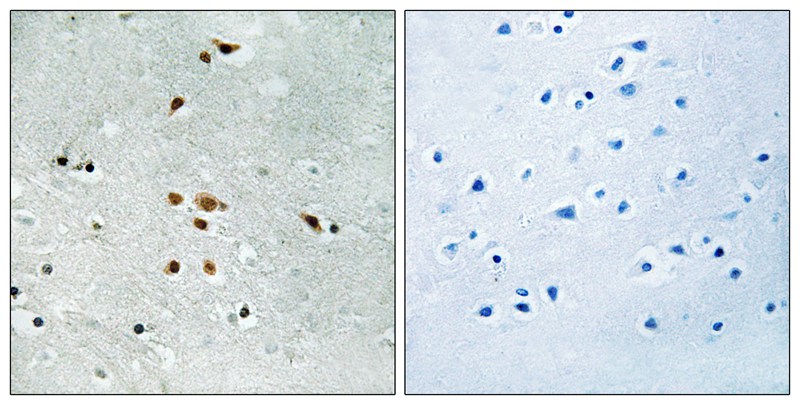 FER (Phospho-Tyr402) Antibody