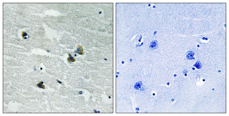 MER/SKY (Phospho-Tyr749/681) Antibody