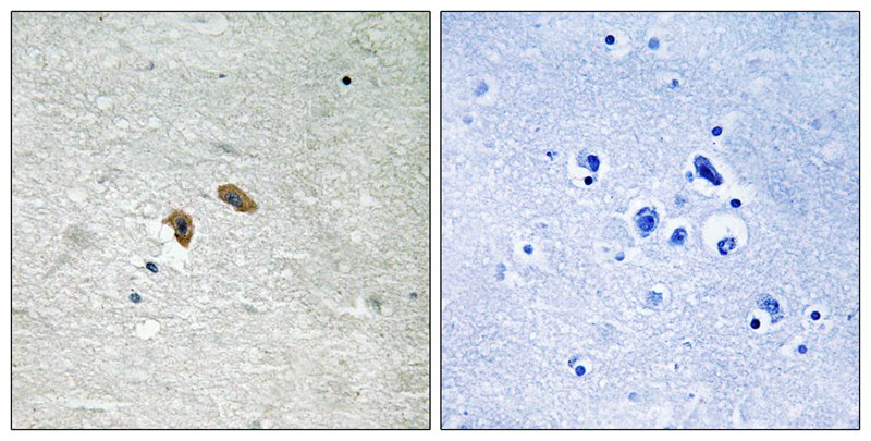 C-RAF (Phospho-Thr269) Antibody