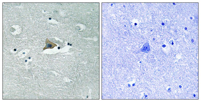 Claudin 5 (Phospho-Tyr217) Antibody