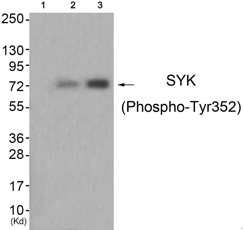 SYK (Phospho-Tyr352) Antibody - SAB | Signalway Antibody