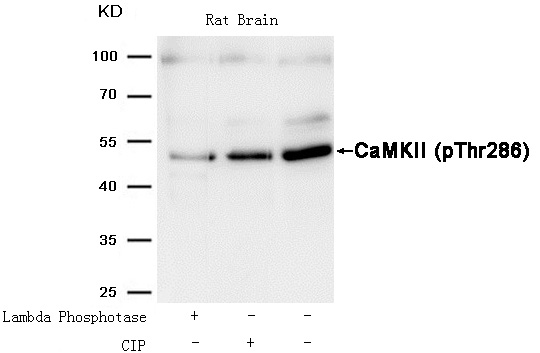 CaMKII(Phospho-Thr286) Antibody