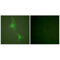 ADD1 (Ab-726) Antibody