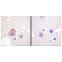 ADD1 (Ab-726) Antibody