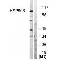HSP90B (Ab-254) Antibody