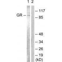 GR (Ab-226) Antibody