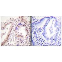 Estrogen Receptor-α (Ab-537) Antibody