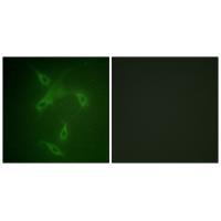 JAK2 (Ab-570) Antibody