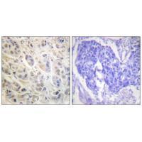 p90 RSK (Ab-573) Antibody