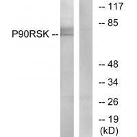 p90 RSK (Ab-573) Antibody