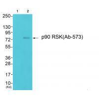 p90 RSK (Ab-573) Antibody