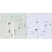 PAK1/2/3 (Ab-423/402/421) Antibody