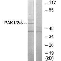 PAK1/2/3 (Ab-423/402/421) Antibody