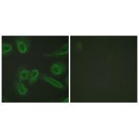 PECAM-1 (Ab-713) Antibody