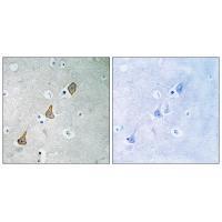PECAM-1 (Ab-713) Antibody