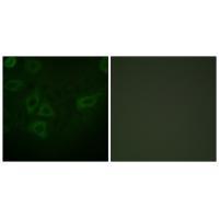 TK (Ab-13) Antibody
