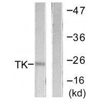 TK (Ab-13) Antibody