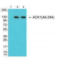 ACK1 (Ab-284) Antibody