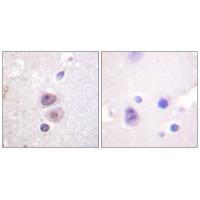 p38 MAPK (Ab-322) Antibody