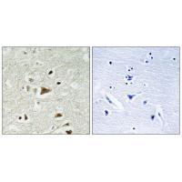 Smad2 (Ab-220) Antibody
