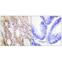 Smad3 (Ab-204) Antibody