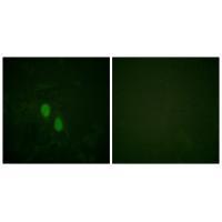 hnRPD (Ab-83) Antibody
