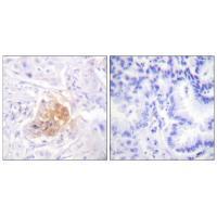 IL-2Rβ/CD122 (Ab-364) Antibody