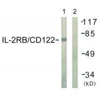 IL-2Rβ/CD122 (Ab-364) Antibody