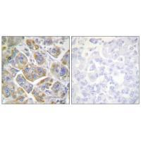ITGB4 (Ab-1510) Antibody