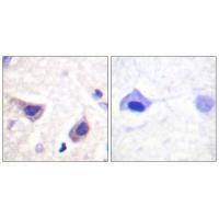 JAK3 (Ab-785) Antibody